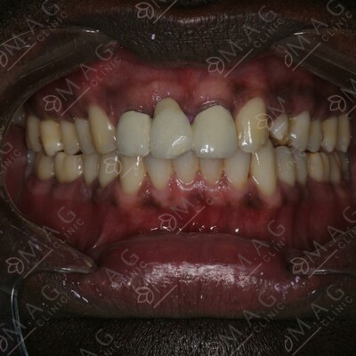 Before